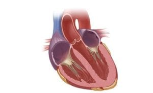 التهاب غشاء القلب