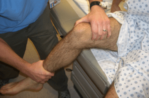 علاج صابونة الركبة