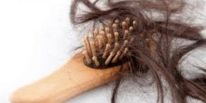 علاج تساقط الشعر الشديد 