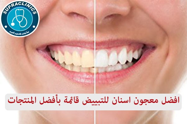 افضل معجون اسنان للتبييض