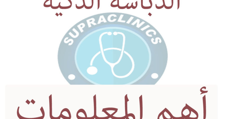 الدباسات الذكية