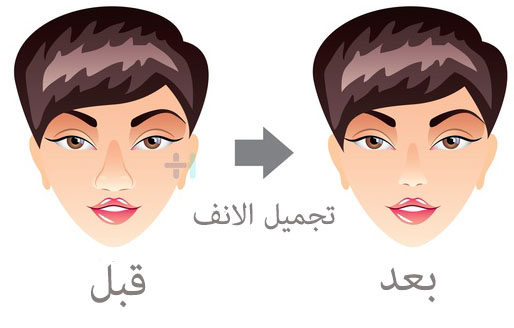 متوسط اسعار عمليات تجميل الانف فى مصر