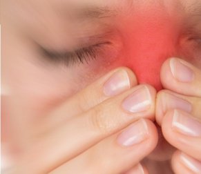 طرق علاج الجيوب الانفية طبياً